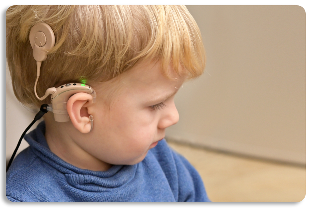 Cochlear Implant Rehabilitation