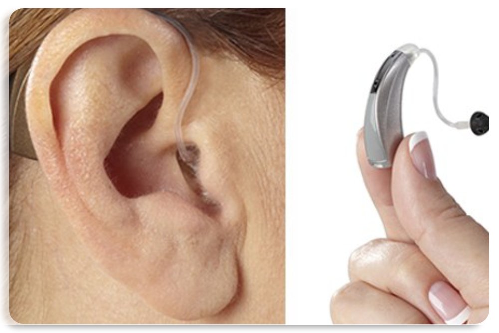 hearingaidtrialfitting
