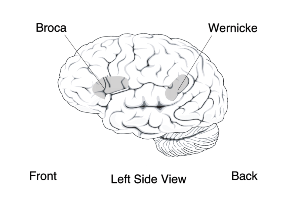 Stroke-Patient-_-Aphasia (2)
